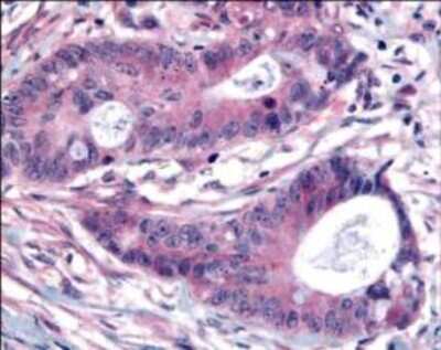 Immunohistochemistry: PLK1 [p Thr210] Antibody [NBP1-78021]